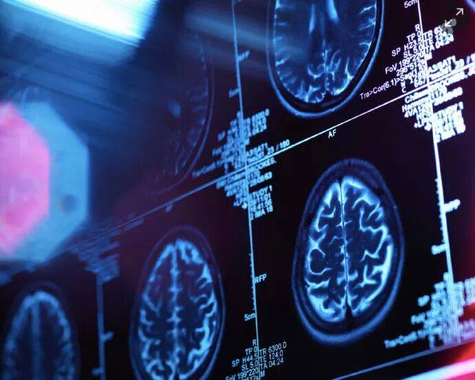 老金遗体藏家中丨冷兔小报 No1226开元棋牌意大利一男子扮成亡母模样骗养